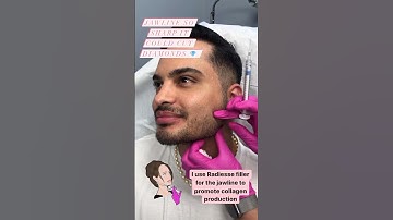 JAWLINE FILLER FOR MEN!