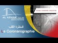 La coronarographie  