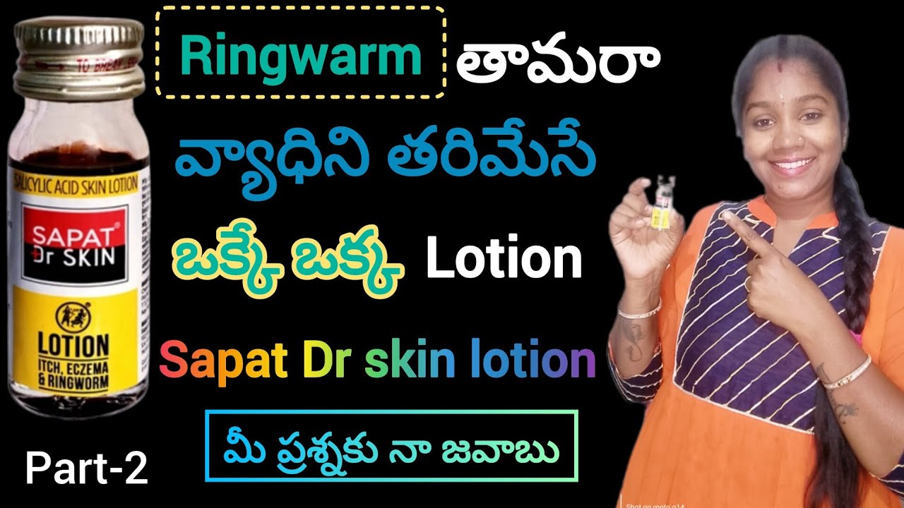 Allergies & Fungal Infection control with sapt DR Skin Lotion in Telugu | Ringwarm Cure | తామరా |