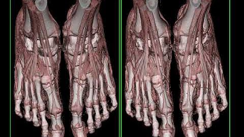 Cinematic Rendering - Clinical Applications and Future Directions Part 1