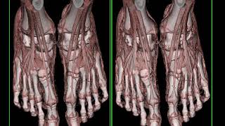 Cinematic Rendering - Clinical Applications and Future Directions Part 1