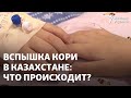 30 детей в реанимации. Вспышка кори в Казахстане: что происходит?