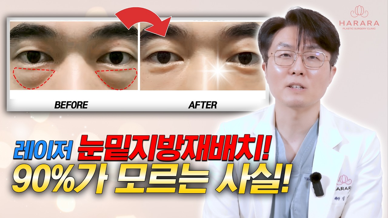 레이저 눈밑지방재배치 고민 중이세요?  '안' 하는 데는 다 이유가 있습니다. 👁️🚫 | 눈밑지방재배치 2편