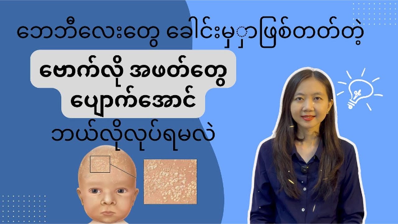 ဘေဘီလေးတွေ ခေါင်းမှာဖြစ်တတ်တဲ့ ဗောက်လိုအဖတ်တွေ ပျောက်အောင်ဘယ်လိုလုပ်မလဲ | Cradle Cap | By Dr. Lwin