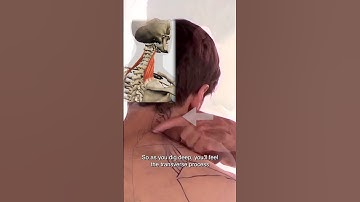 How To Locate Levator Scapulae Trigger Points