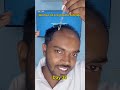 Day 38 | 180 days hair regrowth challenge #manmatters #lifeisbutadream #shorts