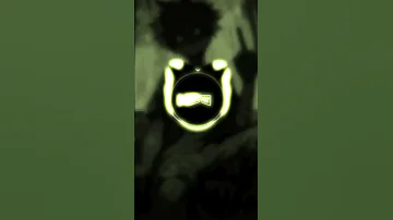 LOST ASTRONAUT ULTRA SLOWED Music Remix LOSTASTRONAUT ULTRASLOWED Avee Player Slowed 