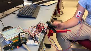 Team Bionics - EMG Controlled Robotic Arm