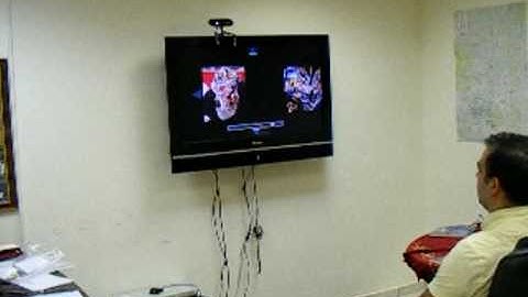 ExSense for VETRINAII - Ex-Sight.COM