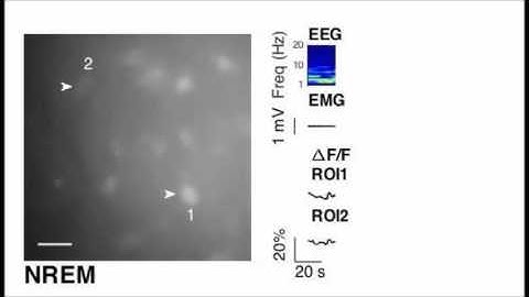 Calcium imaging of sleep–wake related neuronal activity in the dorsal pons