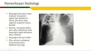 Bakteri Tuberkolosis ternyata di Indonesia menjadi penyakit menular paru-paru yang paling banyak men. 