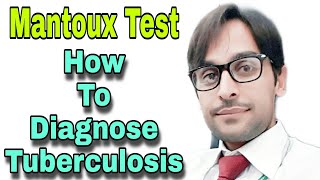 Mantoux Test | Tuberculin Skin Test for TB