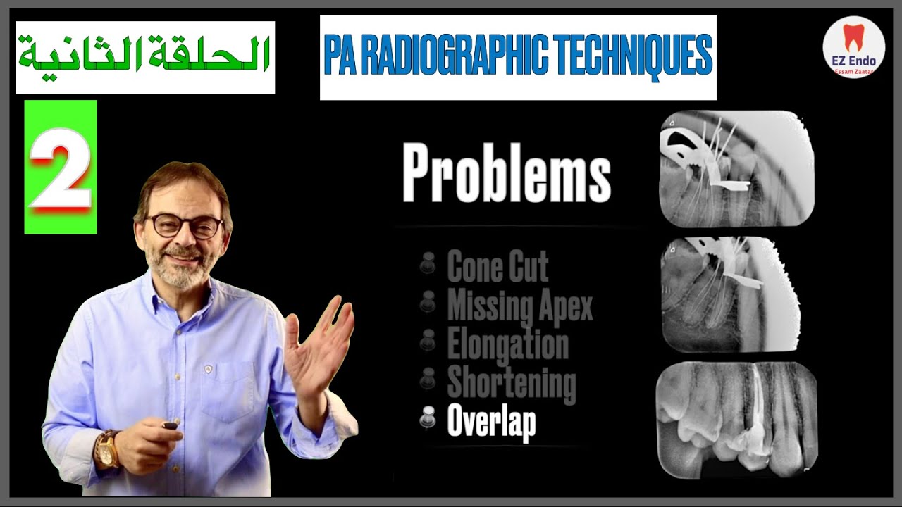 Taking Periapical Radiographs II الحلقة الثانية الطرق السليمة لتصوير أشعة الأسنان أثناء علاج الاندو