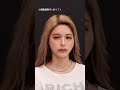 それガーチャー?ほんまゴメンやで🙏nuts専属モデルの今井アンジェリカさんの小顔脂肪吸引を担当しました✨👨⚕️✔︎糸リフト✔︎ジョールファット除去✔︎メーラーファット除去✔︎顎ヒアルロン酸