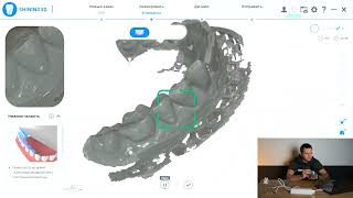 : ,       Shining 3D Aoralscan 3