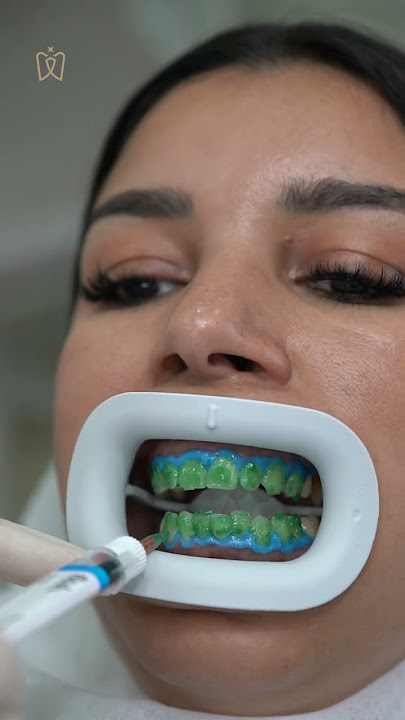 With these simple steps, you can achieve your pearly white teeth.