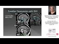 Linda Gray Leithe, MD, Neuroradiology | Spontaneous Intracranial Hypotension: Avoiding Misdiagnosis