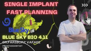 Details blue sky 4.11 single implant-english tutorial.mp4 News