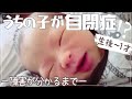 〜自閉症が分かるまで〜障害の初期症状👶🏻【後追い無し/低緊張/体幹の悪さ/てんかん】