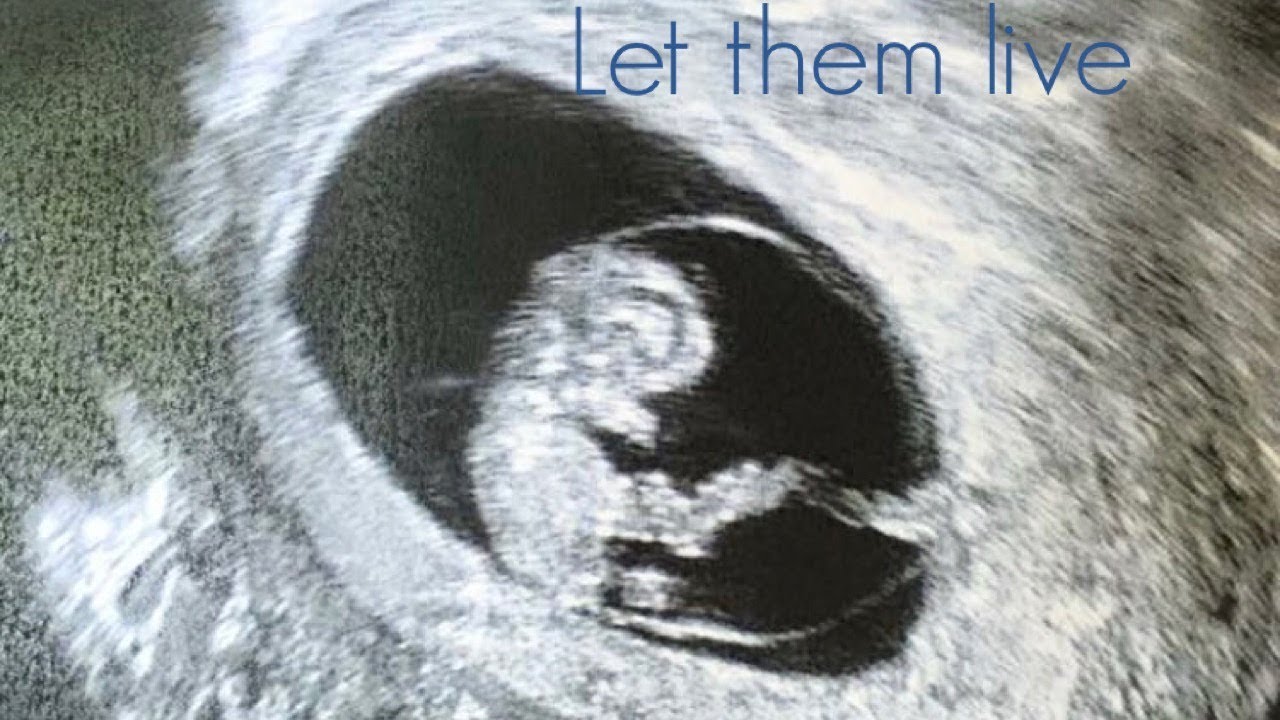On abortion... Warning - TEARS throughout - YouTube