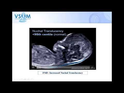 Video Hình ảnh chìa khóa trong siêu âm sản khoa (Key Images... - youtube