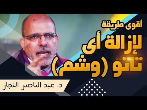 عملت تاتو وشم وندمت كيو سويتش ليزر أفضل طريقه طبية لإزالة التاتو أو الوشم