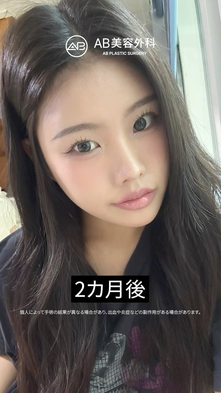 輪郭3点で出会った、新しい私✨ #Shorts