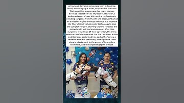 CONJOINED TWINS SEPARATED AFTER 27 HOUR SURGERY USING VR TECHNOLOGY 🧠💡