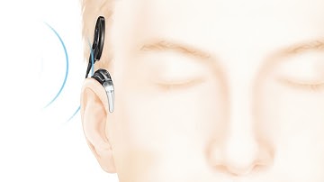 How the Cochlear™ Nucleus® implant system works