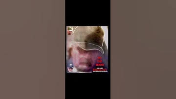 DELPHI MURDERS UPDATE BRIDGE GUY (BG): RL Was BG!  6’2”, RA ~ 5’6”, Do The Math! (!$!+!) #delphi