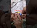 iv cannula fix 🥼🥼#hospital #viralvideo #viralsong #doctor #medical #medicaltutorial
