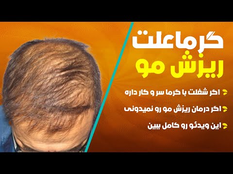 تصویری: آیا داروهای هومیوپاتی می توانند باعث ریزش مو شوند؟