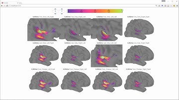 Angular2 D3 threejs MEG Realtime Visualization