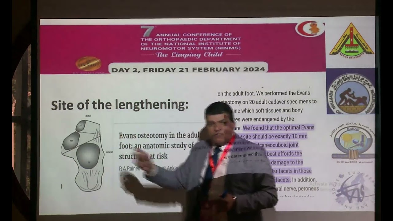 Day2 Workshop correction of pesplanovalgus feet & arthroereisis - Mahmoud Abouzeid