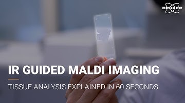 IR Guided MALDI Imaging in 60 seconds | Cancer Tissue Analysis Redefined