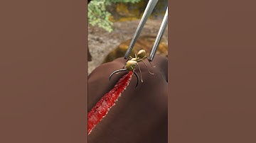 Army Ants Used To Heal Soldier’s Wound🐜