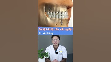 Sai lệch khớp cắn, cắn ngược | Nha Khoa Minh Châu