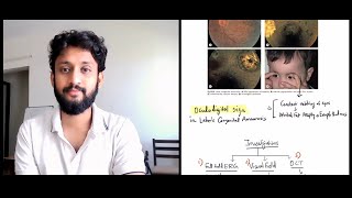 Case 12: Retinitis Pigmentosa - The Complete Review Case 12: Retinitis Pigmentosa - The Complete Review