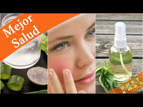 Vídeo: 5 Remedios Naturales Para Ayudar A Calmar La Piel Irritada