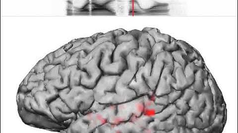 How speech sounds activate the brain