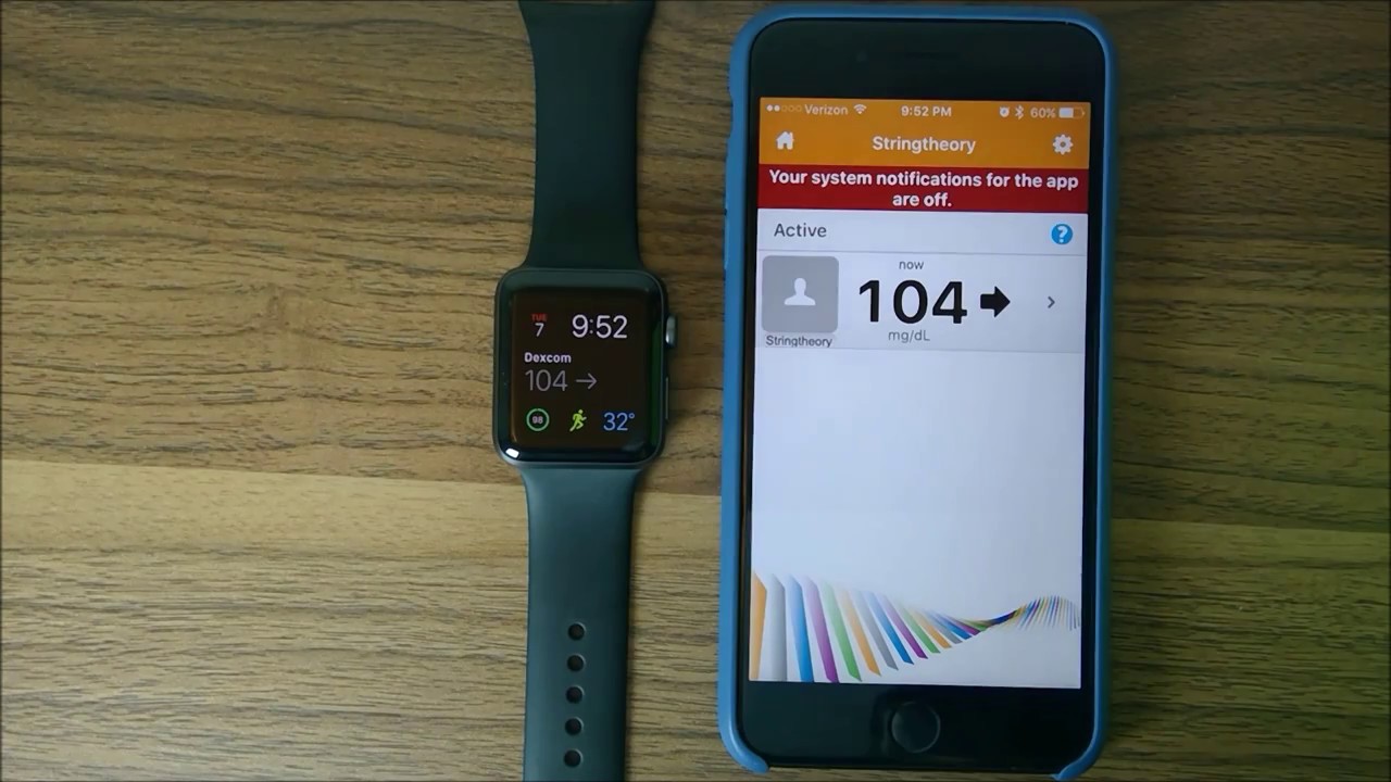 dexcom smartwatch