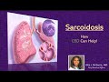 Cbd and sarcoidosis