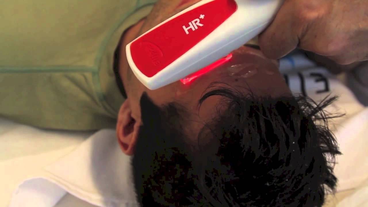 Male eyebrow IPL YouTube