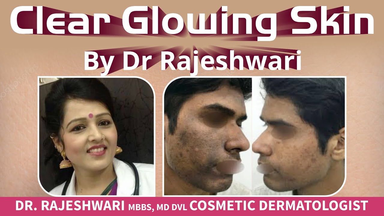Clear Glowing Skin By Dr. Rajeshwari Dr Rajeshwari's Health Care