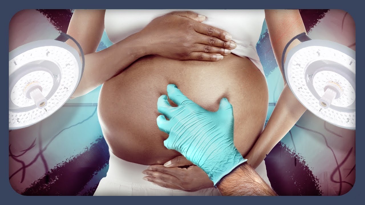 Krasse Geburt im Fahrstuhl: 24-Jährige schafft es nicht in Kreißsaal | Klinik am Südring | SAT.1 TV