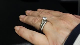 Mayo Clinic Minute: Wedding ring rash