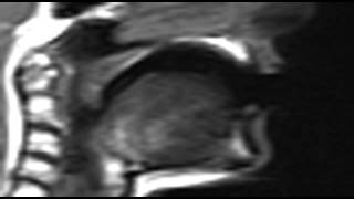 Ultrax MRI vd labial velar approximant