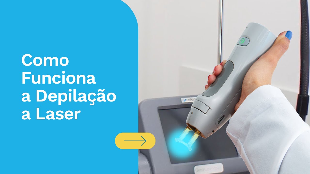 Depilação a Laser Axilas Feminino - Pacote Completo - Promoção (10