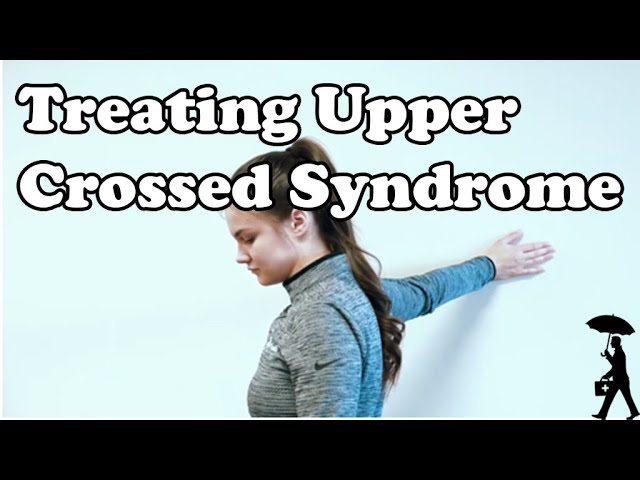 Treating Upper Crossed Syndrome 