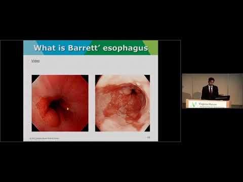 “Barrett’s Esophagus: What You Need to Know if You Have Heartburn”?